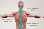 Understanding Cervical, Thoracic, or Lumbar Sprain or Strain