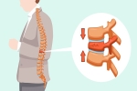 Understanding Vertebral Compression Fractures