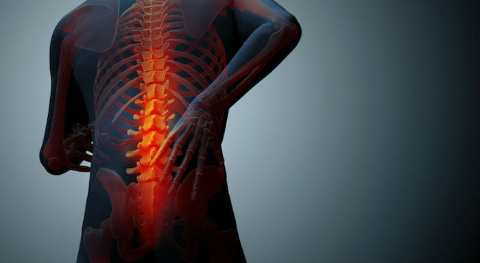 Is Poor Posture the Cause of Your Back Pain?